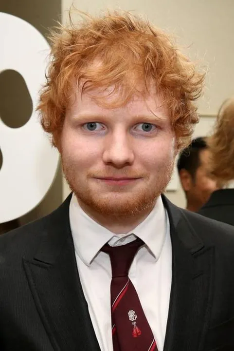Ed Sheeran is ugly
