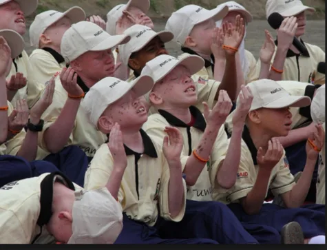 Albinism killings in Malawi