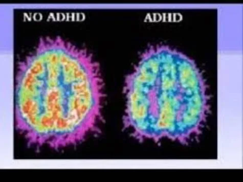 Support for Adult and children with ADHD and Loved ones