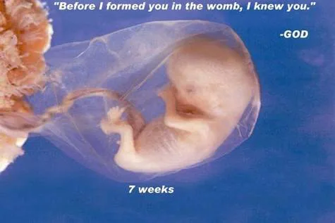  PETITION TO END ABORTION!