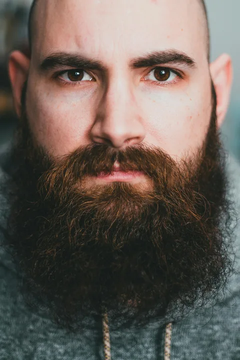 Save Tyson's beard