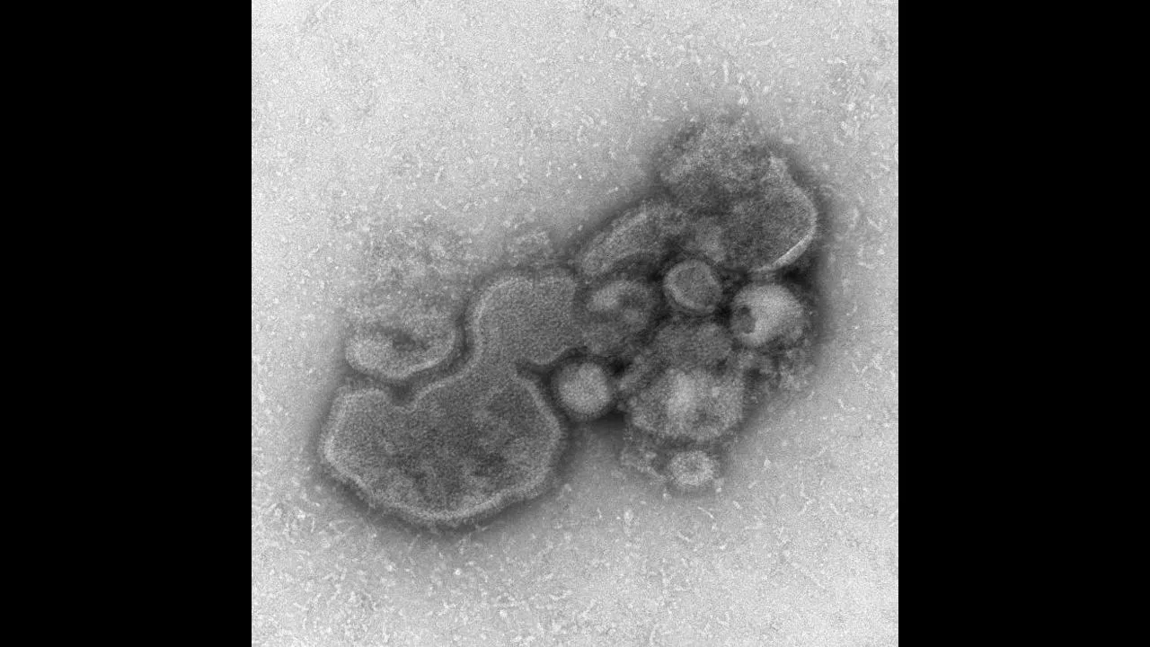 Influenza Pandemic