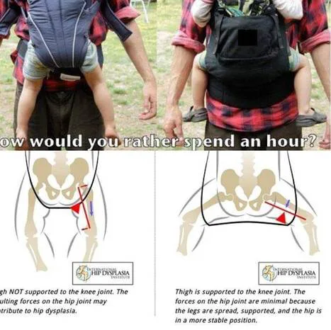 Only Ergonomical Carriers