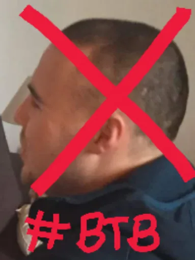 Back to Bald