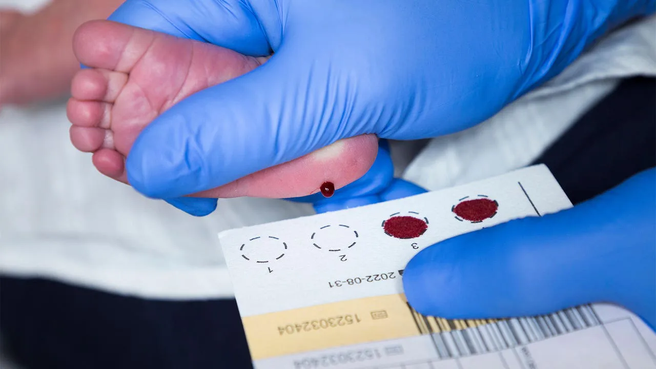 Newborn screening for cystic fibrosis in Nova Scotia