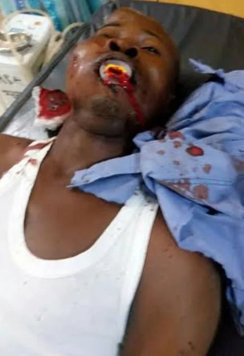 JUSTICE: CP HYELASINDA MUSA KIMO, INVESTIGATE AND PERSECUTE THE MURDERERS OF EDAH OGHENERUKEVWE RICHARD AND STOP POLICE RECKLESS DRIVING