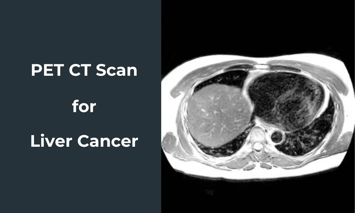 Appropriate scans for ocular melanoma