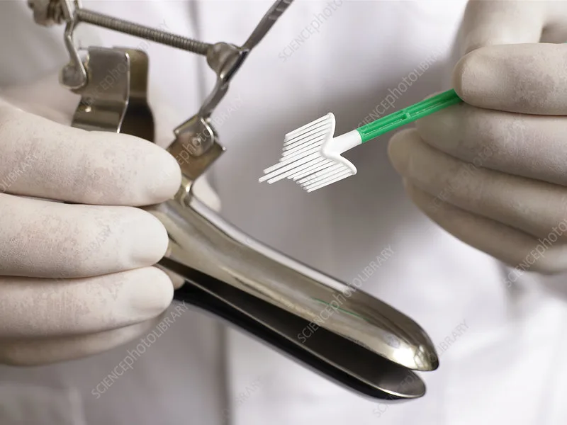 Make Cervical Screening Free in New Zealand