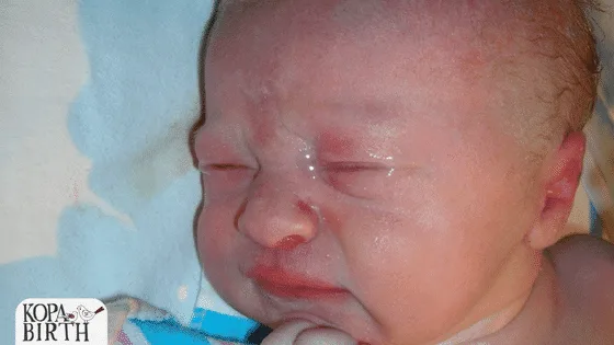 Stop Unnecessary Antibiotic Eye Treatment for Newborns!!!