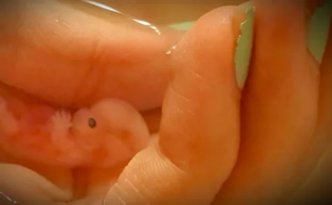 BABY AND MUM BOTH HAVE A RIGHT TO LIFE! PLEASE SHARE TO GET 2000 SIGNATURES