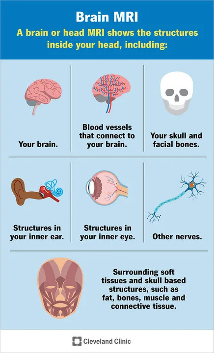 Brain Cyst Awareness