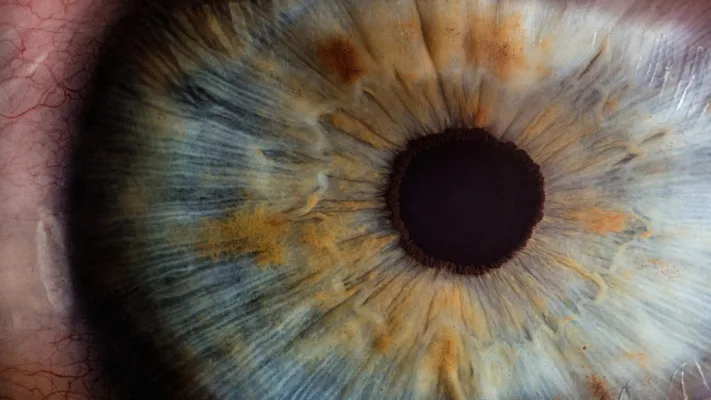 Oppose LCDs and open up access to all MIGS options for glaucoma patients