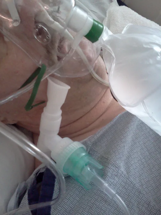 Make Oxygen Therapy Safer