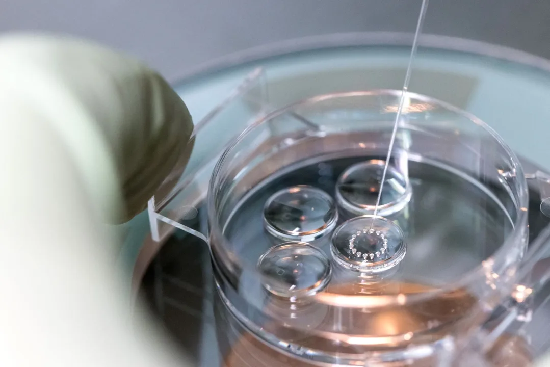 IVF Funding In Essex