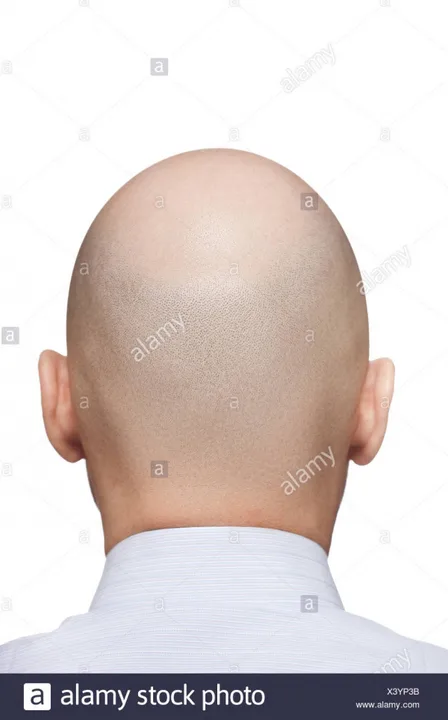 michael goes bald