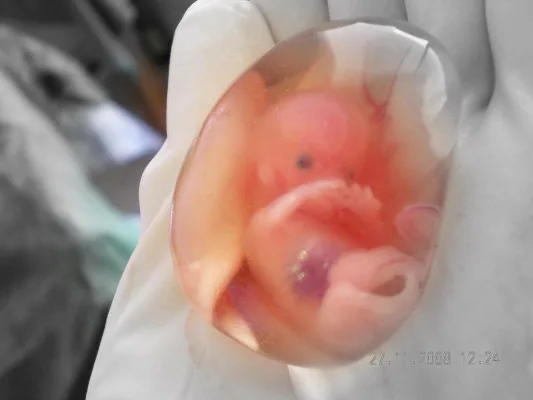 Burial for Unborn Babies Aborted in Ireland
