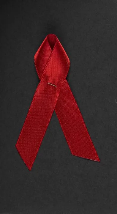 Sculptra for PWAs (People with AIDS) - Compassionate Use Program