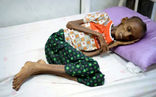 Stop famine in Yemen