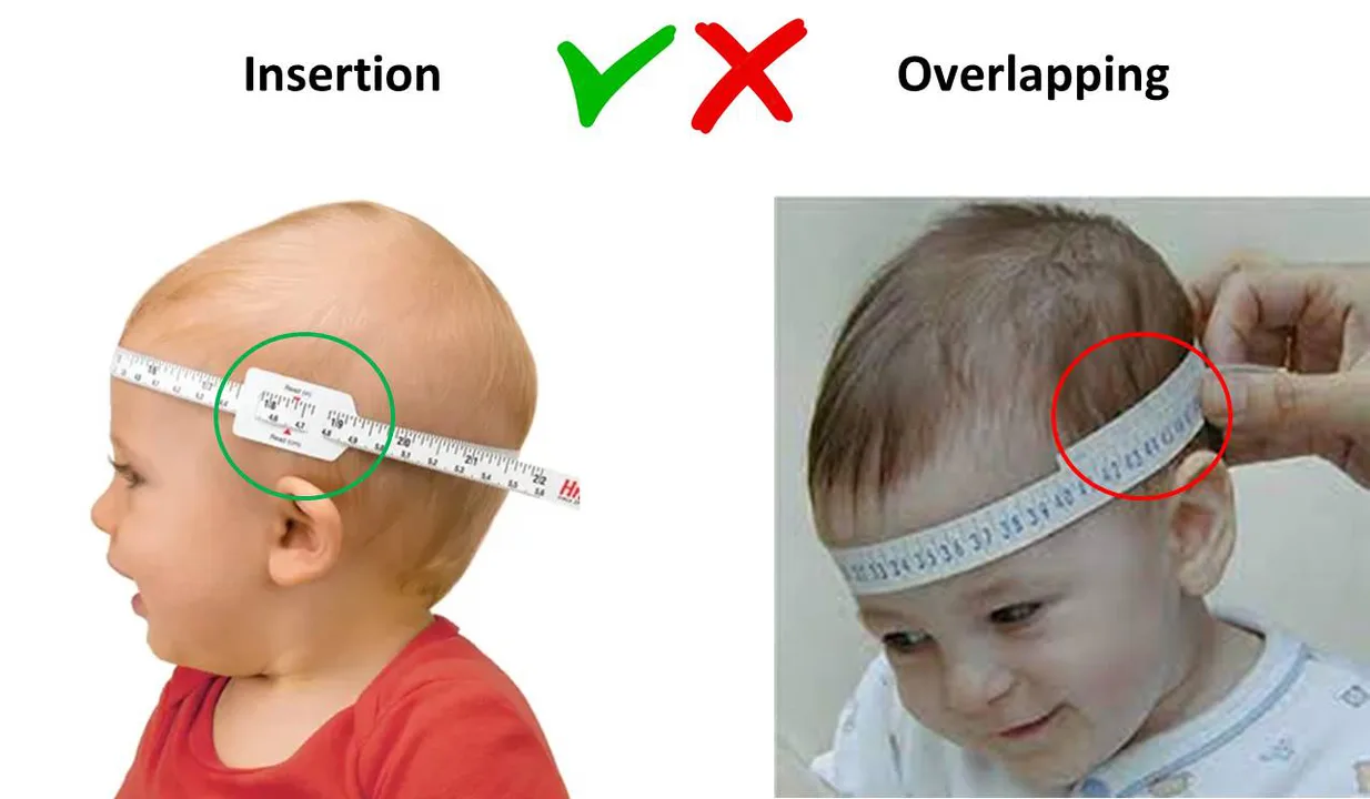 Re-instate the measuring of head circumference at birth