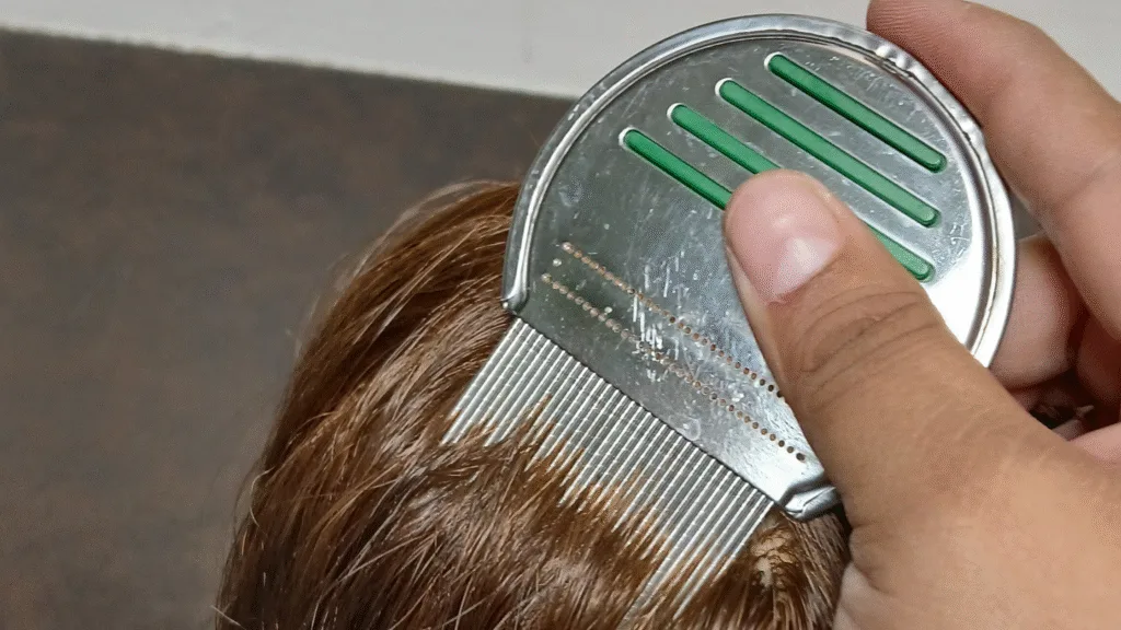 Netzaberg elementary lice policy