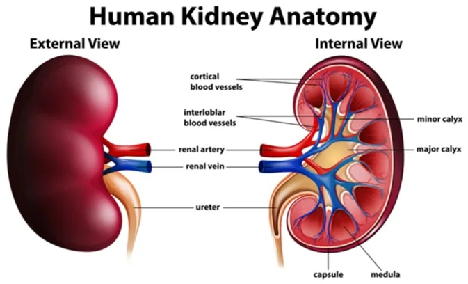 Medullary Sponge Kidney (MSK) Patients Unite - One Voice, Several Goals