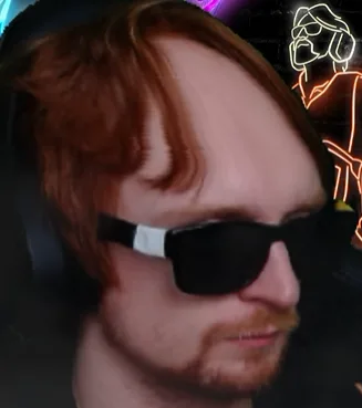 NEON SHOWS US HIS BALD SPOT